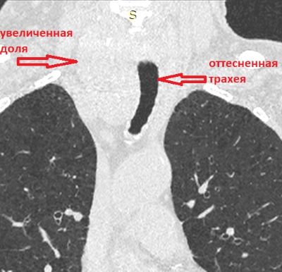 mong1_3.jpg mong1_3.jpg