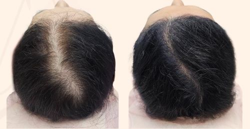 andr-al2.jpg andr-al2.jpg