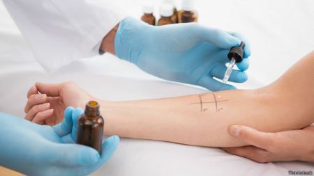 native_allergen_7 (1).jpg native_allergen_7 (1).jpg