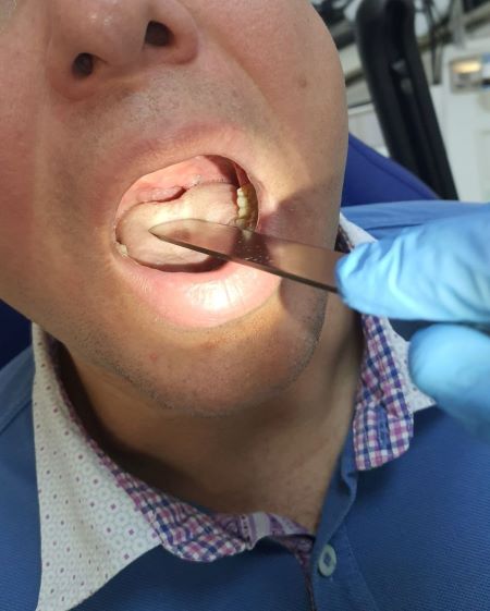 gonch3.jpg gonch3.jpg