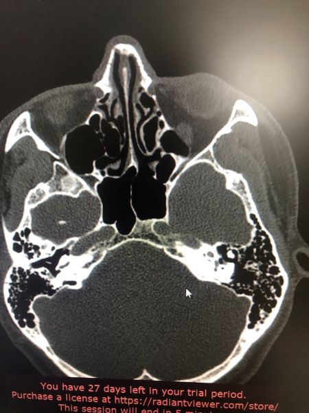 mobile_file_2023-06-16_15-50-01 (2).jpg