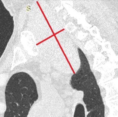 mong1_4.jpg mong1_4.jpg