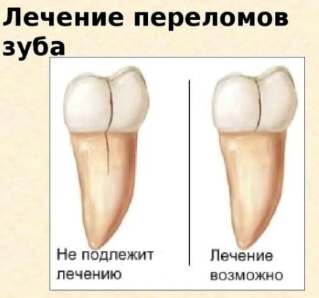 How are dental implants placed? AllDentalTravel.com Dental Tourism in Bulgaria L