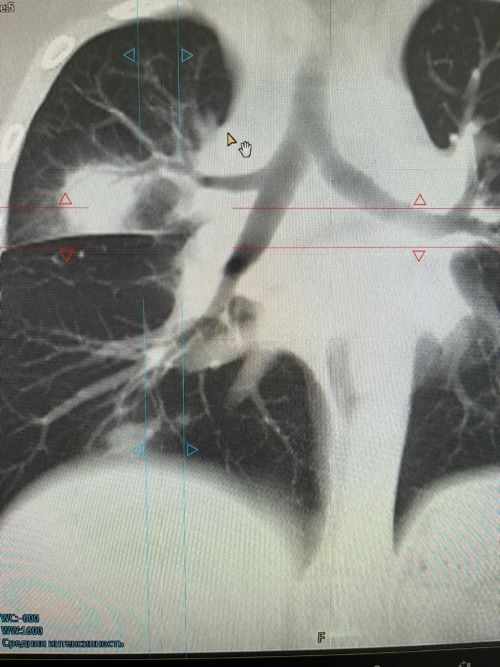 mobile_file_2024-03-05_12-51-54 (1).jpg